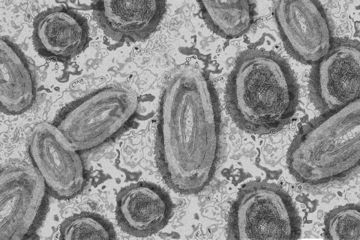 Ministério da Saúde confirma 8º caso de varíola dos macacos no país - Imagem ilustrativa: Pixabay